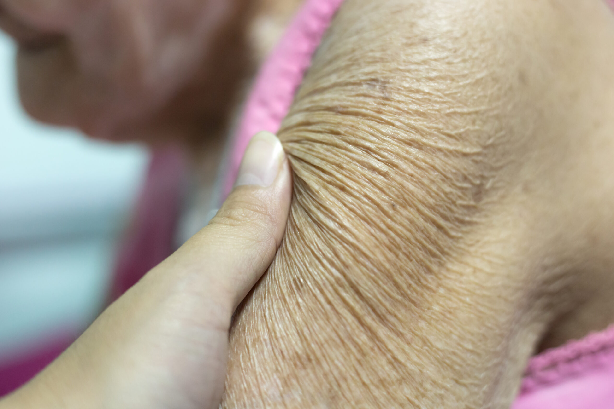 Taking care of elderly skin